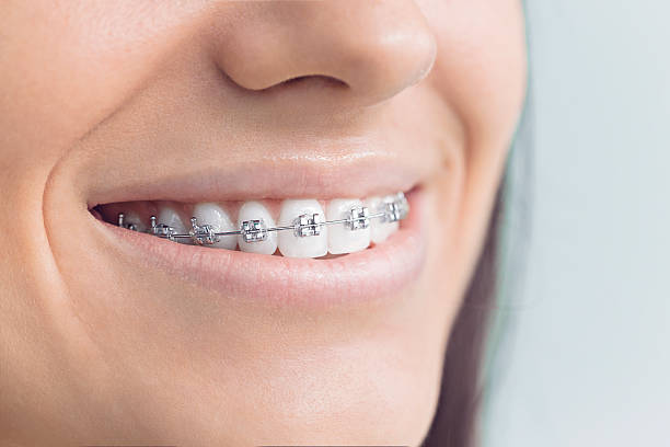 Why Choose Us for Your Dental Needs in Altamonte Springs, FL